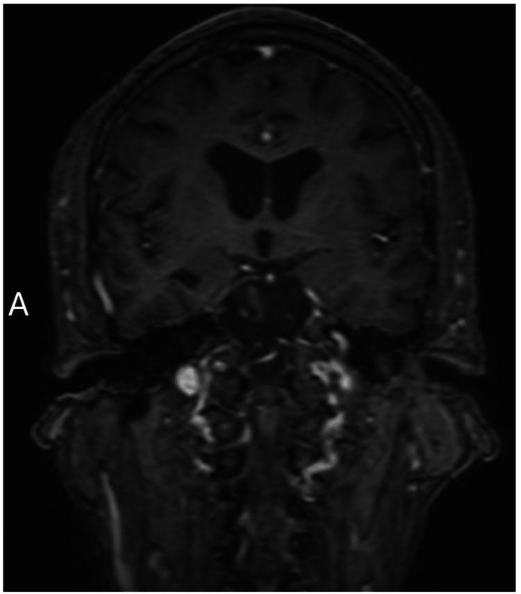 https://cdn.ncbi.nlm.nih.gov/pmc/blobs/4feb/11246706/0e5e6517f4ce/cureus-0016-00000062387-i02.jpg