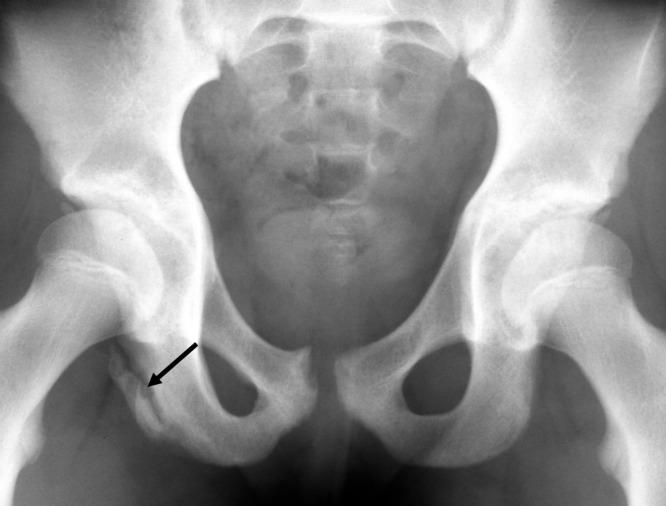 https://cdn.ncbi.nlm.nih.gov/pmc/blobs/4fee/3445246/5f8a2f95546c/10.1177_1941738109334214-fig8.jpg