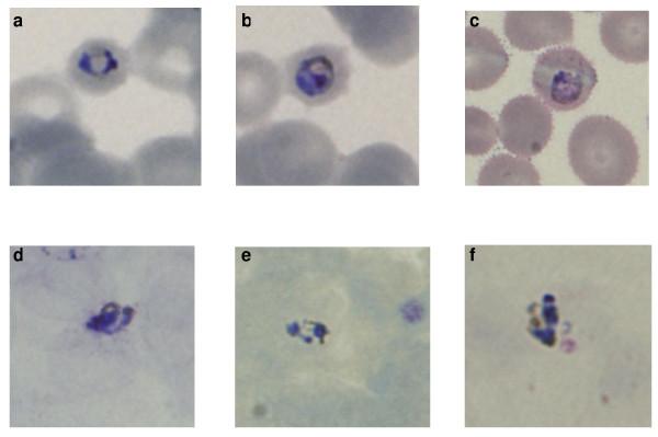 https://cdn.ncbi.nlm.nih.gov/pmc/blobs/4ff6/2634766/25cc5f1423db/1475-2875-8-15-1.jpg