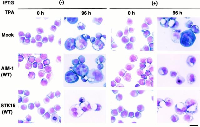 https://cdn.ncbi.nlm.nih.gov/pmc/blobs/4ff7/2199624/14ff275838c8/JCB0003093.f7.jpg