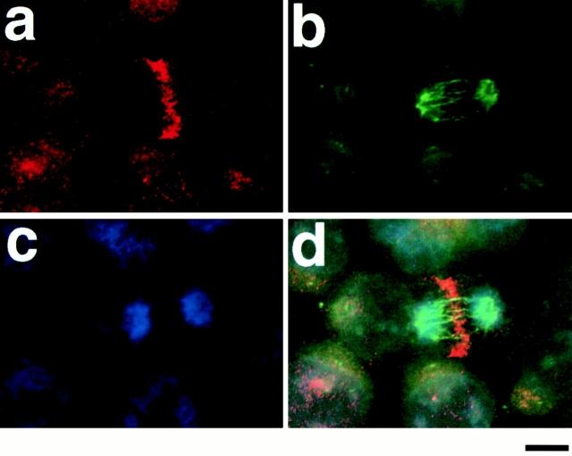 https://cdn.ncbi.nlm.nih.gov/pmc/blobs/4ff7/2199624/44782da174c9/JCB0003093.f8.jpg