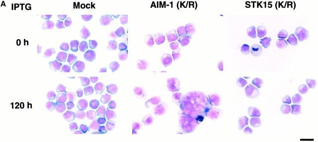 https://cdn.ncbi.nlm.nih.gov/pmc/blobs/4ff7/2199624/5b5cf335a79d/JCB0003093.f10a.jpg