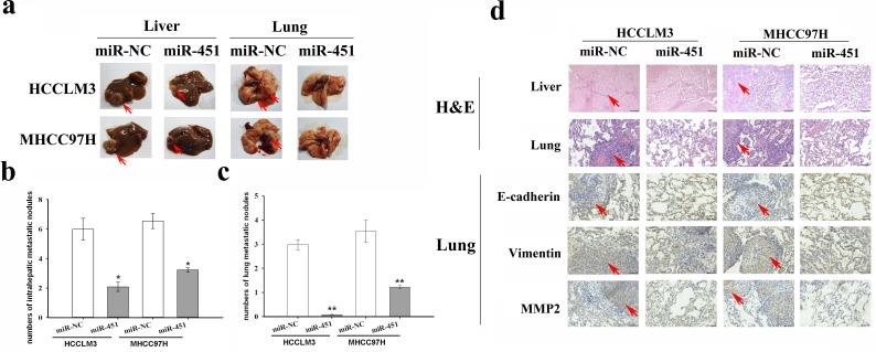 https://cdn.ncbi.nlm.nih.gov/pmc/blobs/4ff7/4621914/faebe6409d63/oncotarget-06-18613-g003.jpg