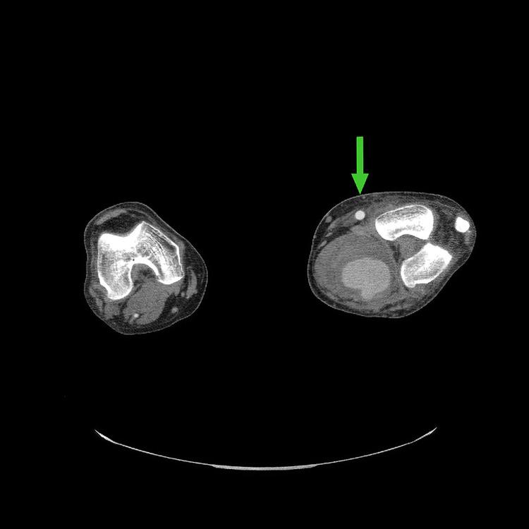 https://cdn.ncbi.nlm.nih.gov/pmc/blobs/4fff/8286778/291df29afad9/cureus-0013-00000015746-i02.jpg