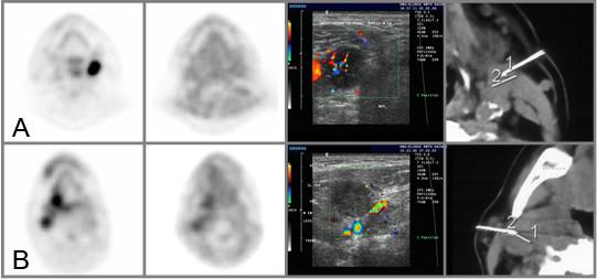 https://cdn.ncbi.nlm.nih.gov/pmc/blobs/5000/1948005/b265503506b5/1471-2407-7-113-2.jpg
