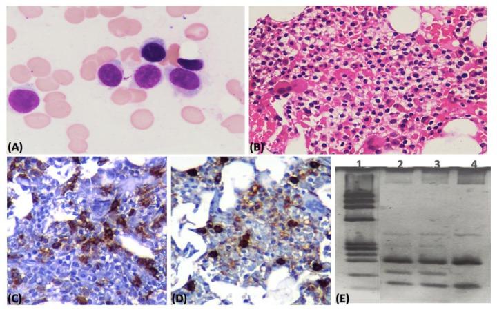 https://cdn.ncbi.nlm.nih.gov/pmc/blobs/5005/5419203/0281efb1a81d/mjhid-9-1-e2017033f1.jpg