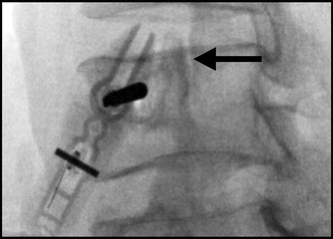 https://cdn.ncbi.nlm.nih.gov/pmc/blobs/5005/9482788/1a8ff7fd7a5d/JPR-15-2801-g0006.jpg