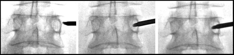 https://cdn.ncbi.nlm.nih.gov/pmc/blobs/5005/9482788/65079fea6ef9/JPR-15-2801-g0007.jpg