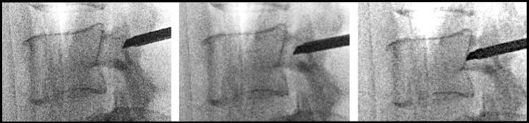 https://cdn.ncbi.nlm.nih.gov/pmc/blobs/5005/9482788/87bc6c01e78c/JPR-15-2801-g0008.jpg