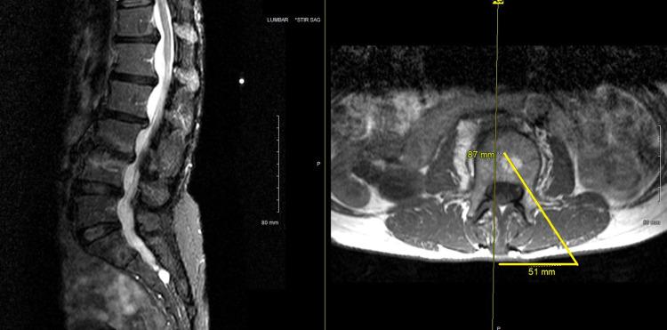 https://cdn.ncbi.nlm.nih.gov/pmc/blobs/5005/9482788/8d181de8ddfb/JPR-15-2801-g0015.jpg