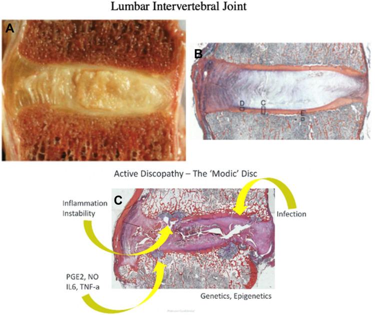 https://cdn.ncbi.nlm.nih.gov/pmc/blobs/5005/9482788/c9bfd5519dfe/JPR-15-2801-g0002.jpg