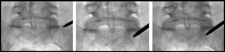 https://cdn.ncbi.nlm.nih.gov/pmc/blobs/5005/9482788/d039e8783694/JPR-15-2801-g0012.jpg