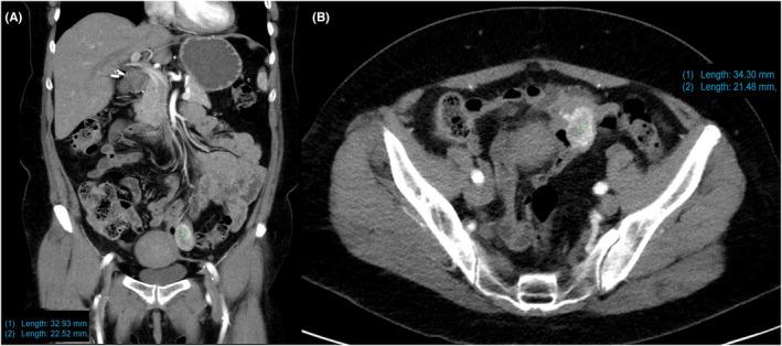 https://cdn.ncbi.nlm.nih.gov/pmc/blobs/5007/9307879/ba5c8ea41d20/CCR3-10-e6082-g003.jpg