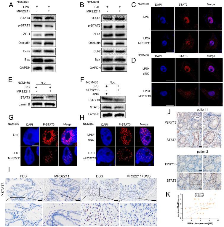 https://cdn.ncbi.nlm.nih.gov/pmc/blobs/500a/9379400/f7da0c8bd5f3/ijbsv18p5056g005.jpg