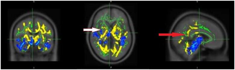 https://cdn.ncbi.nlm.nih.gov/pmc/blobs/500b/12145178/49eb2022ccaa/tzaf014f4.jpg