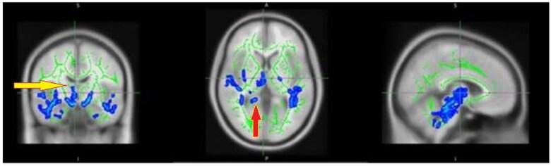 https://cdn.ncbi.nlm.nih.gov/pmc/blobs/500b/12145178/c863a9b4721d/tzaf014f3.jpg