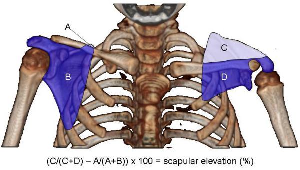 https://cdn.ncbi.nlm.nih.gov/pmc/blobs/500d/2664782/00235736df04/1471-2474-10-32-3.jpg