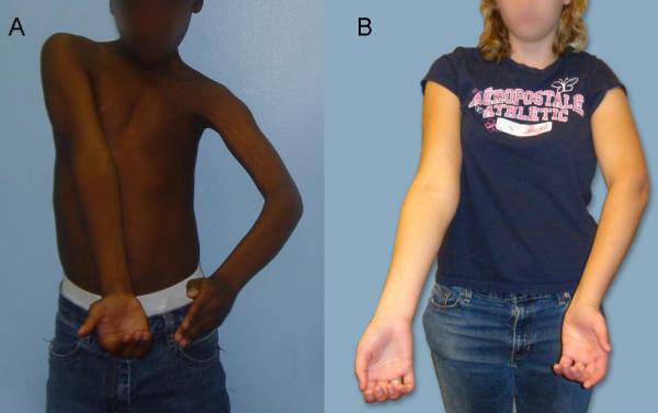 https://cdn.ncbi.nlm.nih.gov/pmc/blobs/500d/2664782/e9c33a256ee3/1471-2474-10-32-2.jpg