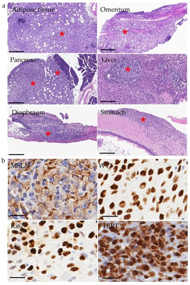 https://cdn.ncbi.nlm.nih.gov/pmc/blobs/5023/9264972/079c08057c5d/cancers-14-03108-g002.jpg