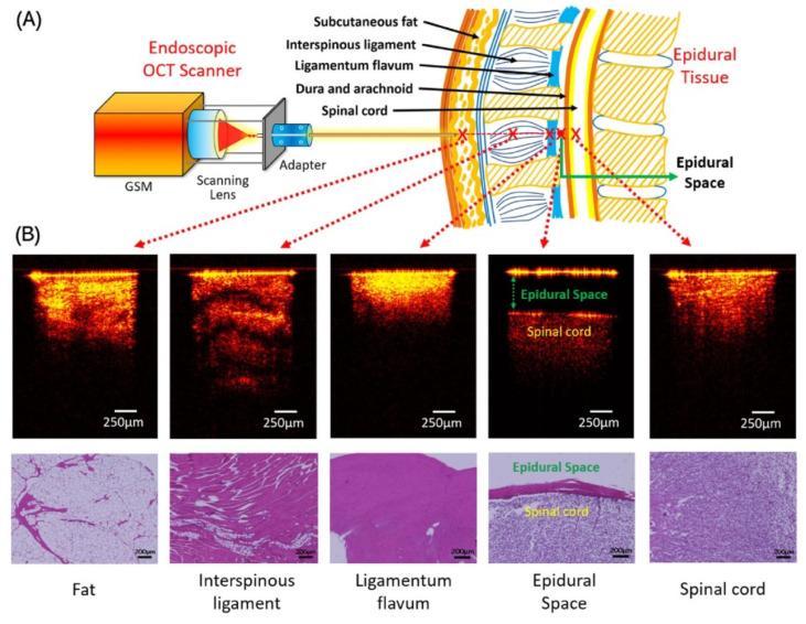 https://cdn.ncbi.nlm.nih.gov/pmc/blobs/5029/10346758/67c71a292328/sensors-23-06065-g010.jpg