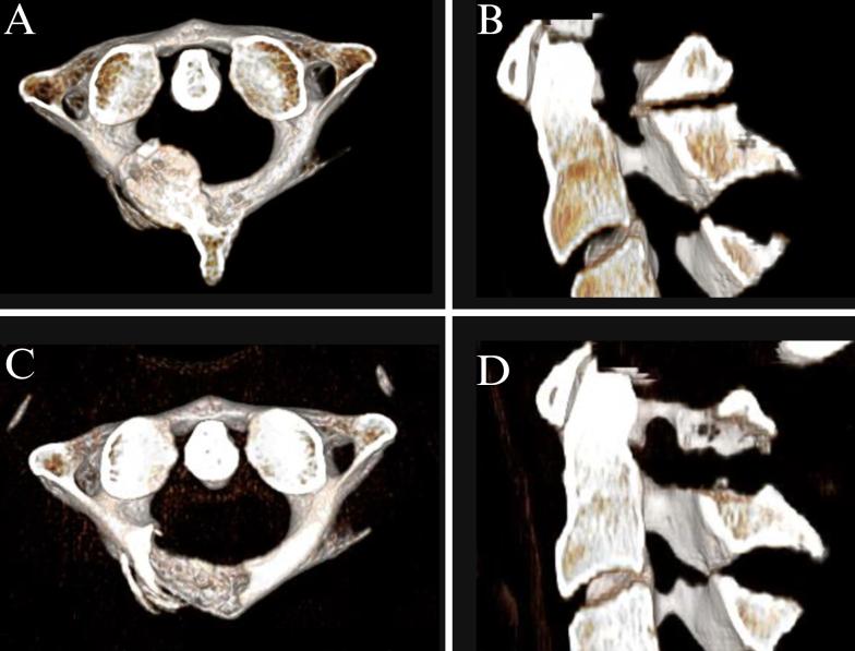 https://cdn.ncbi.nlm.nih.gov/pmc/blobs/502b/12013375/018bec02d87a/CASE24766_figure_3.jpg