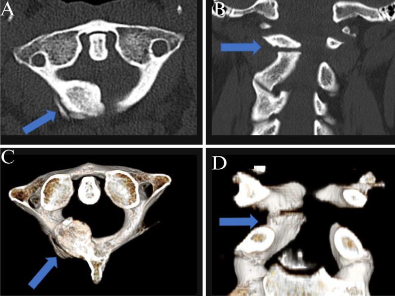 https://cdn.ncbi.nlm.nih.gov/pmc/blobs/502b/12013375/8d2f4a7de628/CASE24766_figure_2.jpg