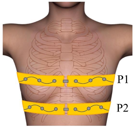 https://cdn.ncbi.nlm.nih.gov/pmc/blobs/502c/5017324/7979490e7537/sensors-16-01158-g012.jpg