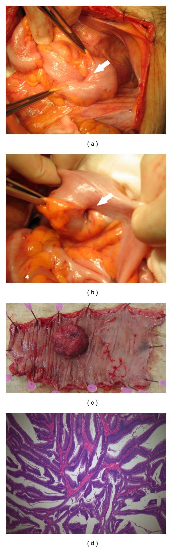 https://cdn.ncbi.nlm.nih.gov/pmc/blobs/502d/4053309/dff45700d218/CRIS2014-696403.004.jpg