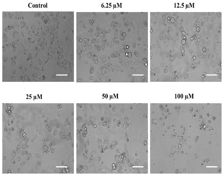 https://cdn.ncbi.nlm.nih.gov/pmc/blobs/502e/10139052/074d8b9012f2/ijms-24-07336-g007.jpg
