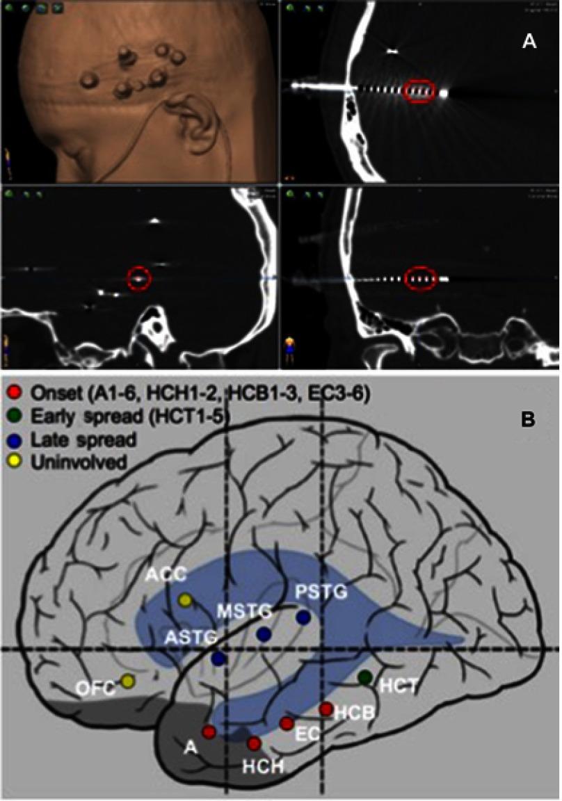 https://cdn.ncbi.nlm.nih.gov/pmc/blobs/5032/6610288/5c950a500a91/NDT-15-1701-g0002.jpg