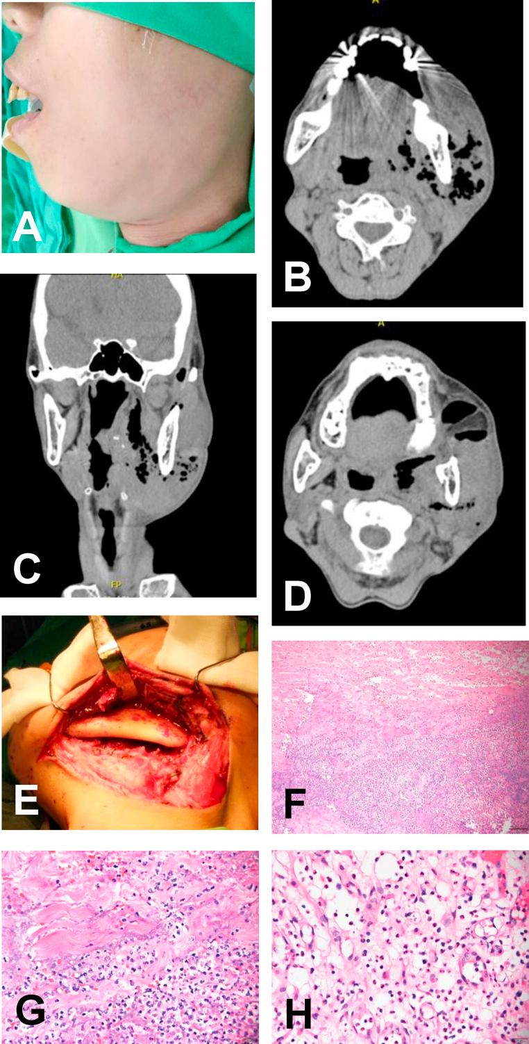 https://cdn.ncbi.nlm.nih.gov/pmc/blobs/5032/7816035/b1bdf9faa44f/gr1.jpg
