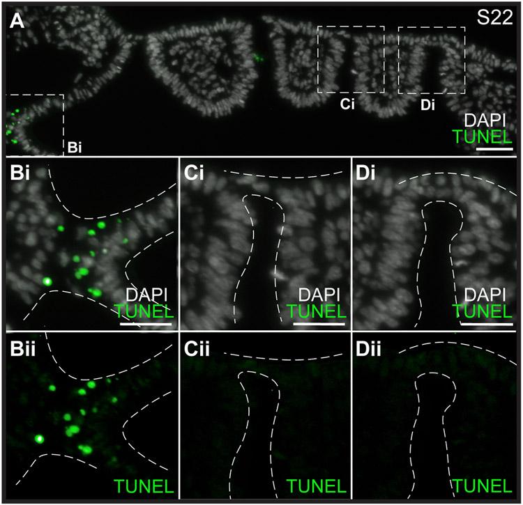 https://cdn.ncbi.nlm.nih.gov/pmc/blobs/503a/11195640/1645904e1696/nihms-2000062-f0004.jpg