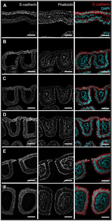 https://cdn.ncbi.nlm.nih.gov/pmc/blobs/503a/11195640/72bf0ca9206f/nihms-2000062-f0002.jpg