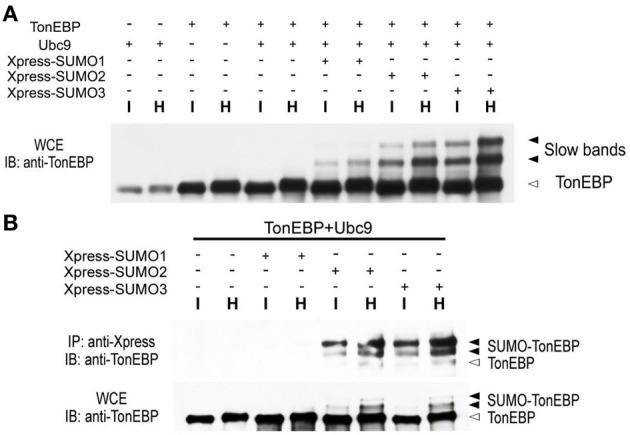 https://cdn.ncbi.nlm.nih.gov/pmc/blobs/5041/4063170/9bc0c4ebd408/fphys-05-00200-g0002.jpg
