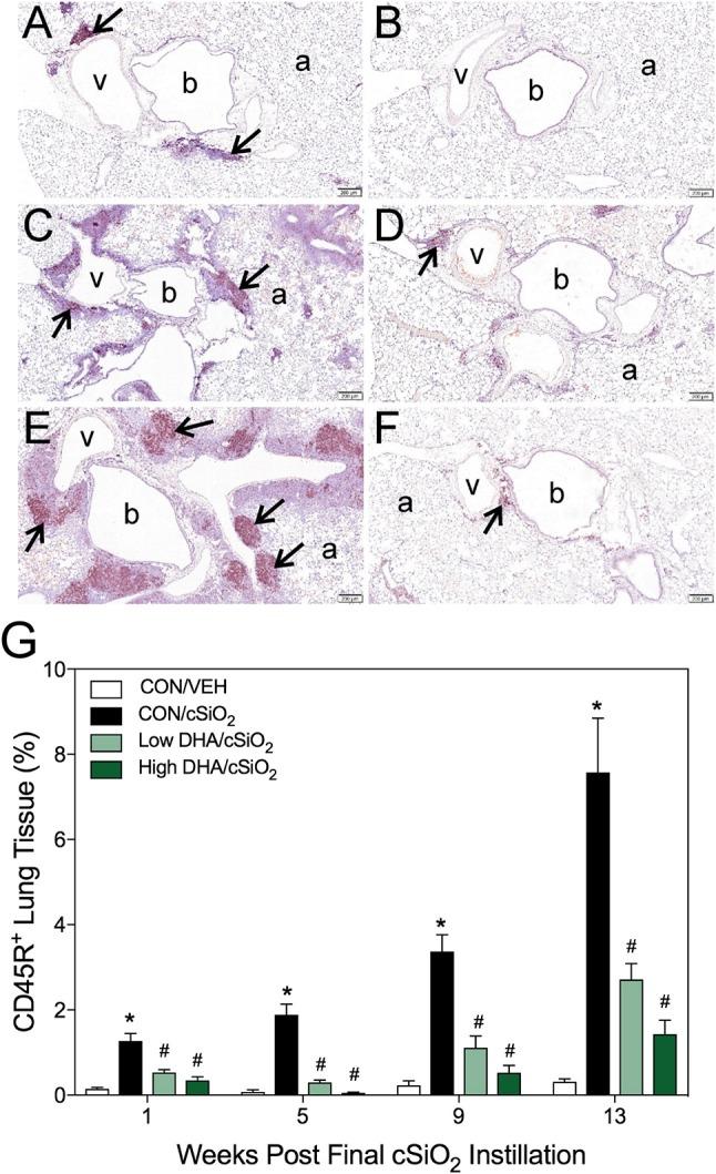 https://cdn.ncbi.nlm.nih.gov/pmc/blobs/5047/6143671/c881d1f0bff5/fimmu-09-02002-g0004.jpg