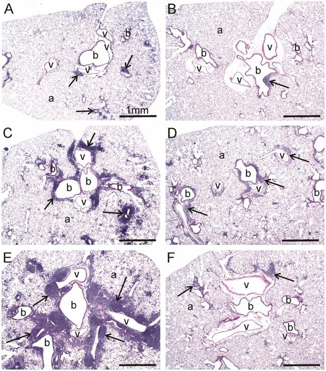 https://cdn.ncbi.nlm.nih.gov/pmc/blobs/5047/6143671/f9b0690f83e2/fimmu-09-02002-g0003.jpg