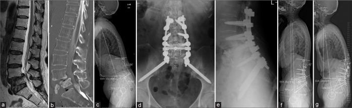 https://cdn.ncbi.nlm.nih.gov/pmc/blobs/5047/7771496/3eba78b130eb/SNI-11-437-g001.jpg