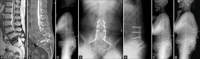 https://cdn.ncbi.nlm.nih.gov/pmc/blobs/5047/7771496/762bef08c85e/SNI-11-437-g003.jpg