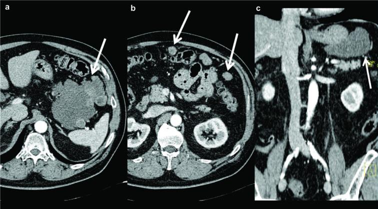 https://cdn.ncbi.nlm.nih.gov/pmc/blobs/504e/6625570/1c82e2ffaba0/ACTA-90-9-g005.jpg
