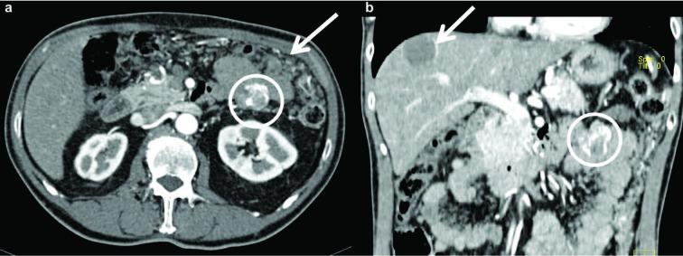 https://cdn.ncbi.nlm.nih.gov/pmc/blobs/504e/6625570/2bdfbe3d8719/ACTA-90-9-g006.jpg