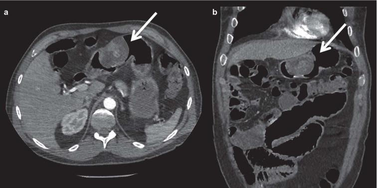 https://cdn.ncbi.nlm.nih.gov/pmc/blobs/504e/6625570/ad84963c16ab/ACTA-90-9-g002.jpg