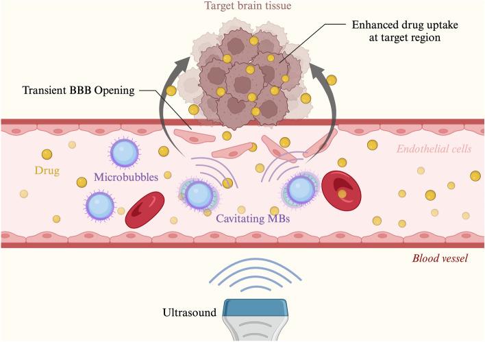 https://cdn.ncbi.nlm.nih.gov/pmc/blobs/5054/11538134/caf24af60361/11060_2024_4795_Fig1_HTML.jpg