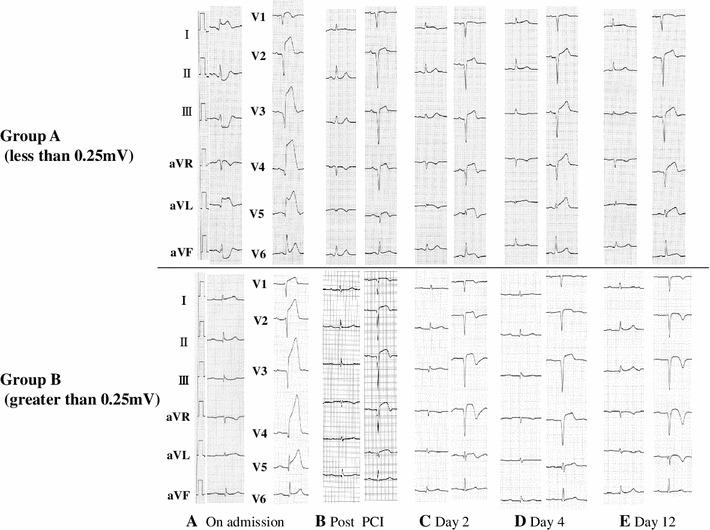 https://cdn.ncbi.nlm.nih.gov/pmc/blobs/5054/3830194/a13d8635f92a/380_2012_313_Fig2_HTML.jpg