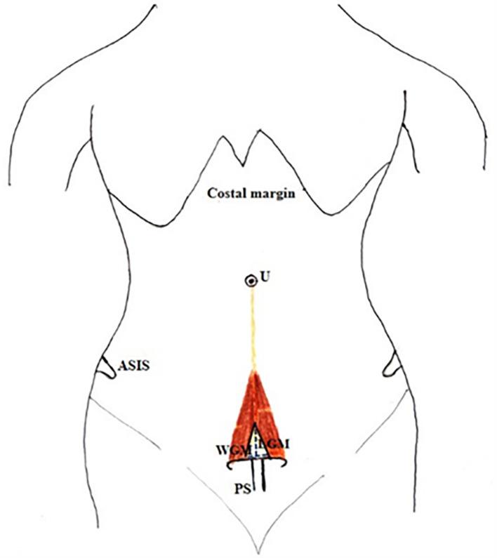 https://cdn.ncbi.nlm.nih.gov/pmc/blobs/5056/10774628/2e07066e2084/f1000research-12-157860-g0001.jpg