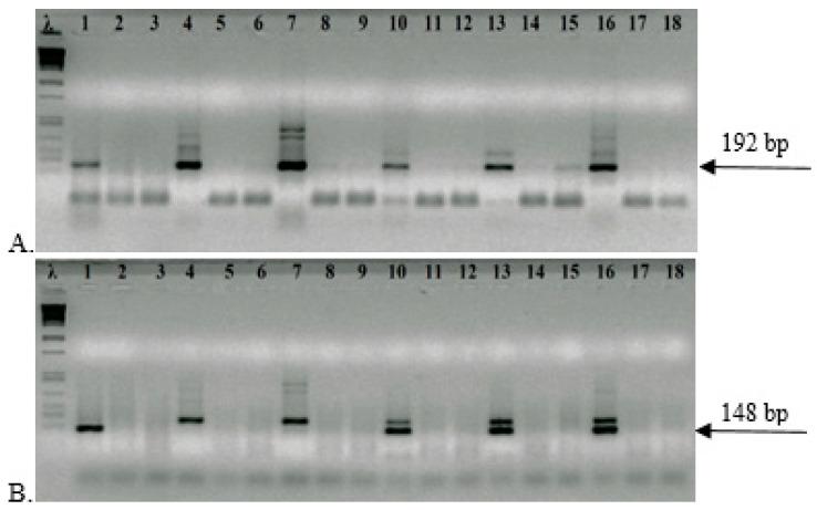 https://cdn.ncbi.nlm.nih.gov/pmc/blobs/5063/12301005/a61f12ec2ba7/microorganisms-13-01498-g001.jpg