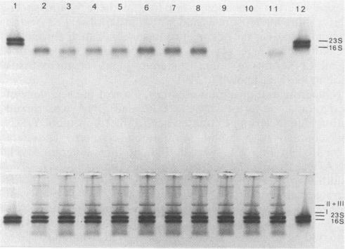 https://cdn.ncbi.nlm.nih.gov/pmc/blobs/5066/269651/2eecd2ce2009/jcm00051-0108-a.jpg