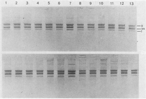 https://cdn.ncbi.nlm.nih.gov/pmc/blobs/5066/269651/d855b35b4f5a/jcm00051-0107-b.jpg