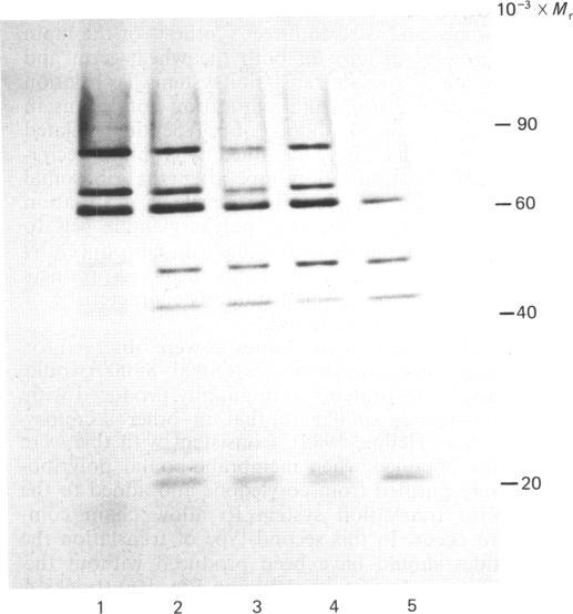 https://cdn.ncbi.nlm.nih.gov/pmc/blobs/5069/1152938/7cada45cb248/biochemj00289-0055-a.jpg