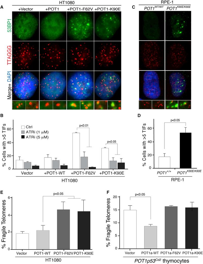 https://cdn.ncbi.nlm.nih.gov/pmc/blobs/506a/6145145/eea590258fdf/nihms-987148-f0004.jpg