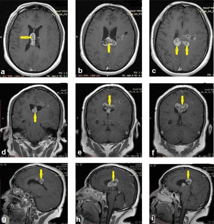 https://cdn.ncbi.nlm.nih.gov/pmc/blobs/506c/7718471/aadfccdaec5e/gr3.jpg